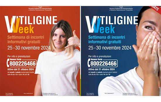  La ‘Vitiligine Week’ arriva in Campania: incontri gratuiti con i dermatologi